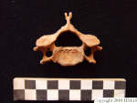 L_V20d5062 A16q42.2 R827 lR ta human bone found in q-lot.JPG L_V20d5062 A16q42.2 R827 lR ta human bone found in q-lot